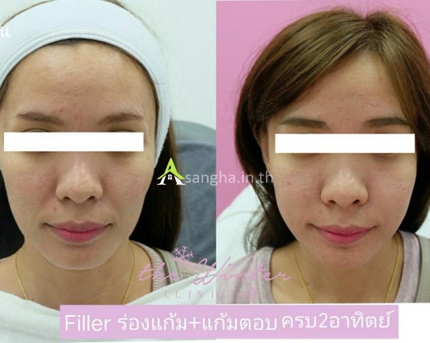 เซ้งกิจการ!! คลินิกเสริมความงาม @Number One Plaza ชั้น1 ม.รามคำแหง 2